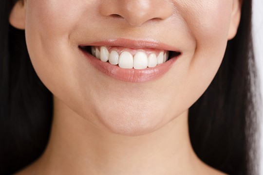 Bọc răng sứ thẩm mỹ
