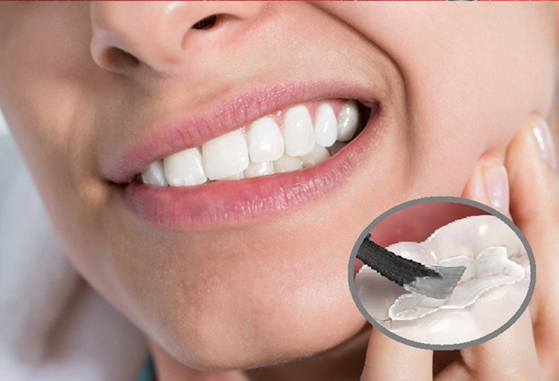 Nguyên nhân và cách xử lý tình trạng nhức răng sau khi trám